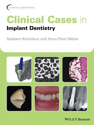 cover image of Clinical Cases in Implant Dentistry